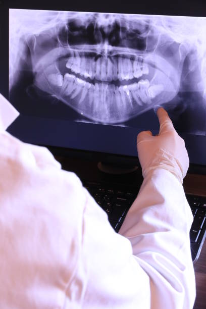 Best Dental Abscess Treatment in Smithville, NJ